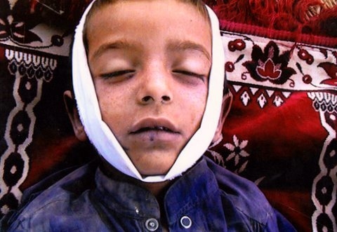 More Than 500 Afghan Civilians, including many Children, Killed in First Quarter, Says UN
